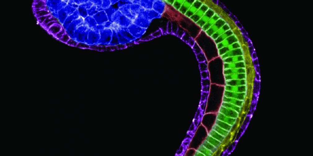 Shaping the Ciona notochord