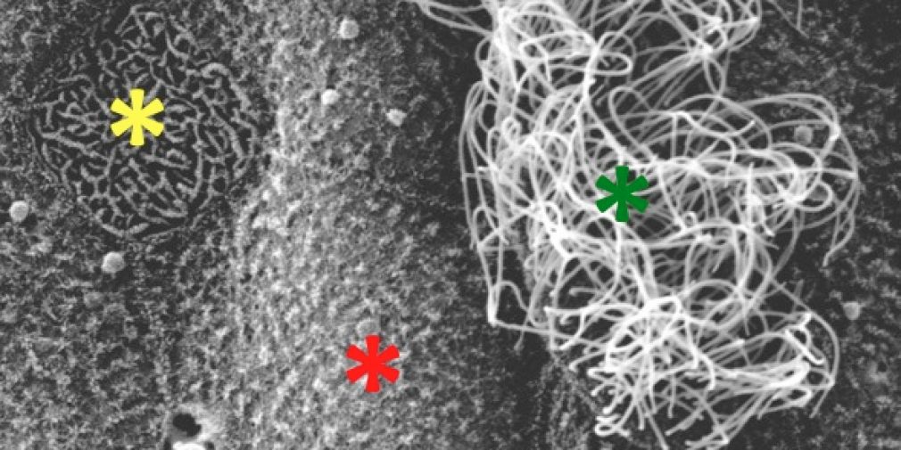 SEMINAR : Building a ciliated epithelium: the example of Xenopus embryonic epidermis