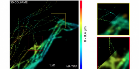 Une méthode qui permet une résolution inégalée des images acquises par un microscope de fluorescence par réflexion totale interne (TIRF)